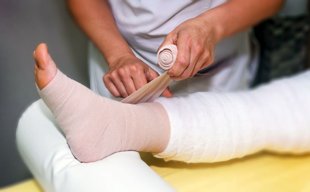 Nurse wrapping a broken ankle